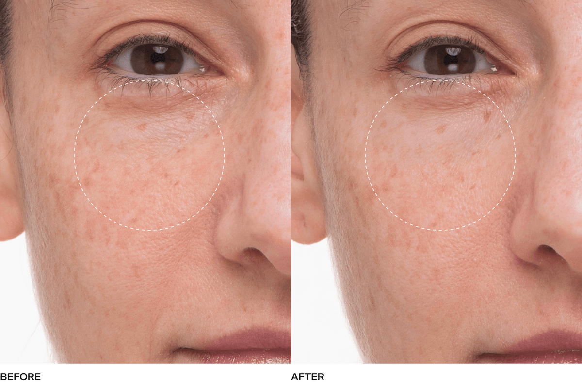 Plumtox Clarifying Enzyme Mask For Skin Renewal