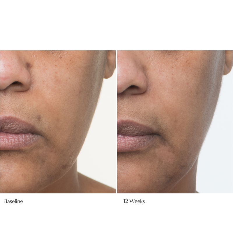 12 week results of using Plumscreen